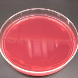 Bacillus subtilis blood microbiology petri dish laboratory technician microbiologia aspergillus nutrient biotechnology niger mikrobiyoloji piastra laboratorio laboratuvar microscope