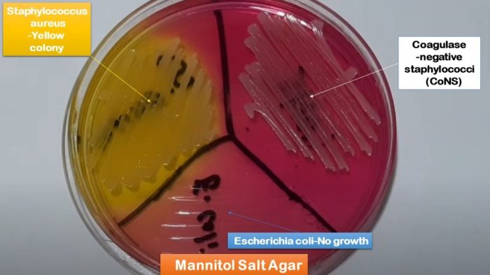 Bacillus subtilis mannitol salt agar