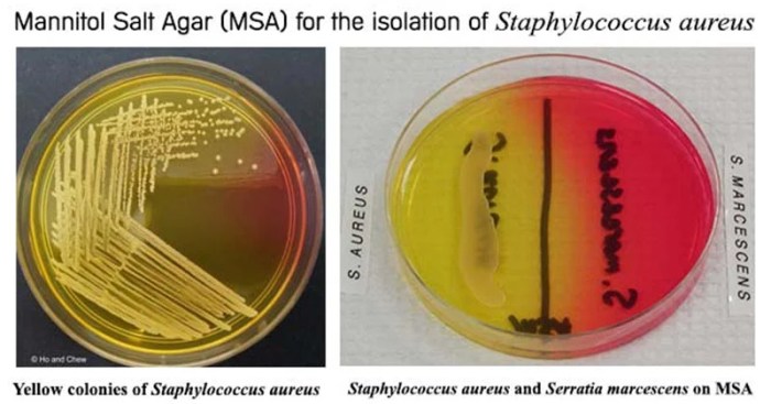 Bacillus subtilis mannitol salt agar